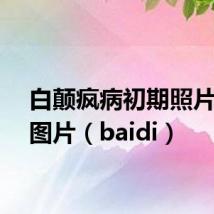 白颠疯病初期照片症状图片(baidi)