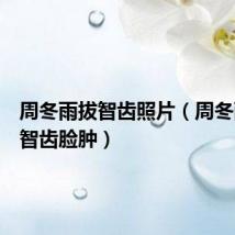 周冬雨拔智齿照片(周冬雨拔完智齿脸肿)