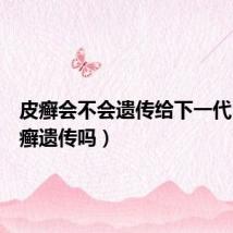 皮癣会不会遗传给下一代(牛皮癣遗传吗)