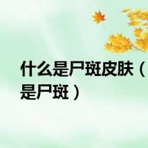 什么是尸斑皮肤（什么是尸斑）