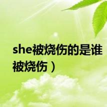 she被烧伤的是谁（she被烧伤）