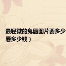 最轻微的兔唇图片要多少钱(兔唇多少钱)