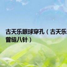古天乐眼球穿孔(古天乐右眼球曾缝八针)