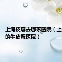 上海皮癣去哪家医院（上海最好的牛皮癣医院）