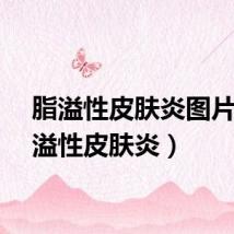 脂溢性皮肤炎图片（脂溢性皮肤炎）
