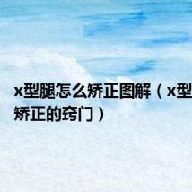 x型腿怎么矫正图解(x型腿怎么矫正的窍门)