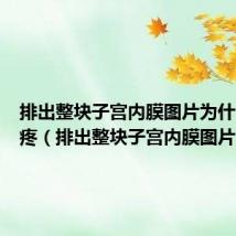 排出整块子宫内膜图片为什么肚子疼(排出整块子宫内膜图片)
