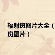辐射斑图片大全（辐射斑图片）