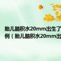 胎儿脑积水20mm出生了治愈案例(胎儿脑积水20mm出生了)
