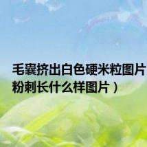 毛囊挤出白色硬米粒图片(白头粉刺长什么样图片)