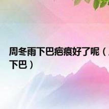 周冬雨下巴疤痕好了呢(周冬雨下巴)