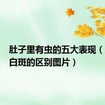 肚子里有虫的五大表现（虫斑和白斑的区别图片）