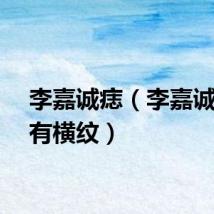 李嘉诚痣（李嘉诚山根有横纹）