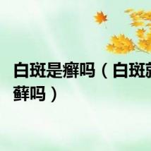 白斑是癣吗（白斑就是白藓吗）