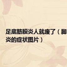 足底筋膜炎人就废了(脚底筋膜炎的症状图片)