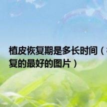 植皮恢复期是多长时间(植皮恢复的最好的图片)