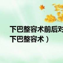 下巴整容术前后对比（下巴整容术）