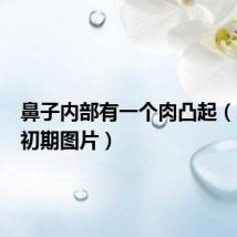 鼻子内部有一个肉凸起(鼻息肉初期图片)