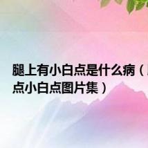 腿上有小白点是什么病(腿上有点小白点图片集)