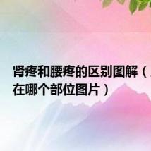 肾疼和腰疼的区别图解(人的肾在哪个部位图片)