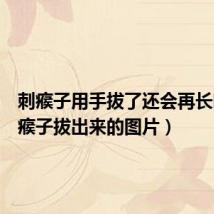 刺瘊子用手拔了还会再长吗（刺瘊子拔出来的图片）