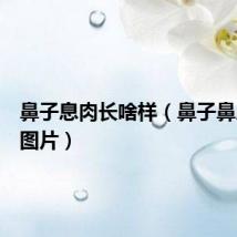 鼻子息肉长啥样（鼻子鼻息肉的图片）