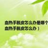 血热手脱皮怎么办是哪个血型（血热手脱皮怎么办）