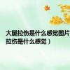 大腿拉伤是什么感觉图片（大腿拉伤是什么感觉）