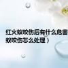 红火蚁咬伤后有什么危害（红火蚁咬伤怎么处理）