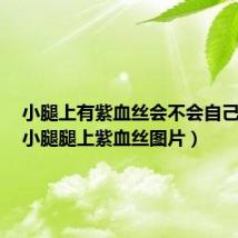 小腿上有紫血丝会不会自己消失(小腿腿上紫血丝图片)