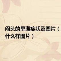 闷头的早期症状及图片(闷头长什么样图片)