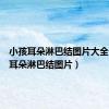 小孩耳朵淋巴结图片大全（小孩耳朵淋巴结图片）