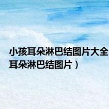 小孩耳朵淋巴结图片大全(小孩耳朵淋巴结图片)