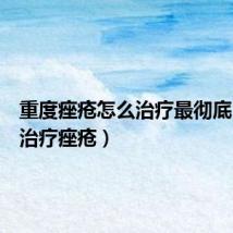 重度痤疮怎么治疗最彻底(怎样治疗痤疮)