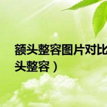 额头整容图片对比（额头整容）