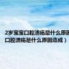 2岁宝宝口腔溃疡是什么原因造成（口腔溃疡是什么原因造成）