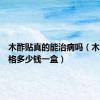 木酢贴真的能治病吗（木酢贴价格多少钱一盒）