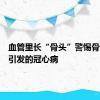血管里长“骨头”警惕骨质疏松引发的冠心病