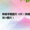 肺癌早期图片 ct片（肺癌早期症状ct图片）