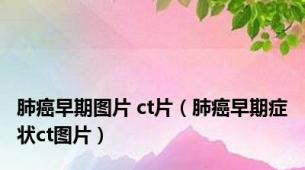 肺癌早期图片 ct片（肺癌早期症状ct图片）