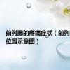 前列腺的疼痛症状（前列腺疼痛位置示意图）
