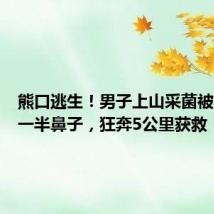 熊口逃生!男子上山采菌被熊咬掉一半鼻子,狂奔5公里获救