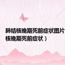 肺结核晚期死前症状图片(肺结核晚期死前症状)