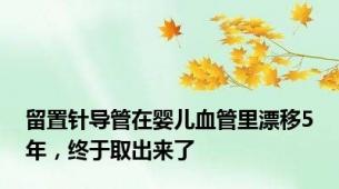 留置针导管在婴儿血管里漂移5年，终于取出来了