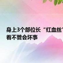 身上3个部位长“红血丝”,拖着不管会坏事