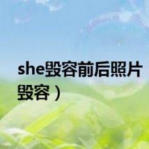 she毁容前后照片（she毁容）