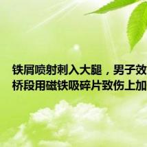 铁屑喷射刺入大腿,男子效仿电影桥段用磁铁吸碎片致伤上加伤