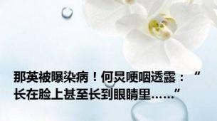 那英被曝染病！何炅哽咽透露：“长在脸上甚至长到眼睛里……”