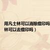 用凡士林可以消除痘印吗（凡士林可以去痘印吗）