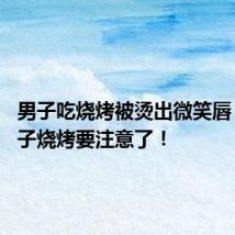 男子吃烧烤被烫出微笑唇 吃铁签子烧烤要注意了!